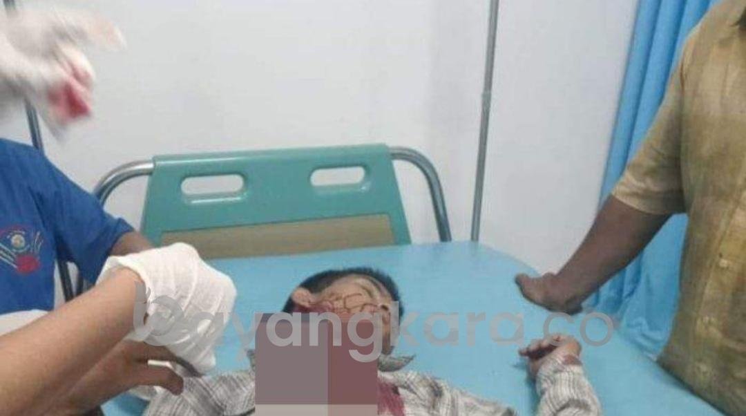 Sadis!! Warga Kelurahan Belawan II Leher Ditebas Orang Tak Dikenal. 