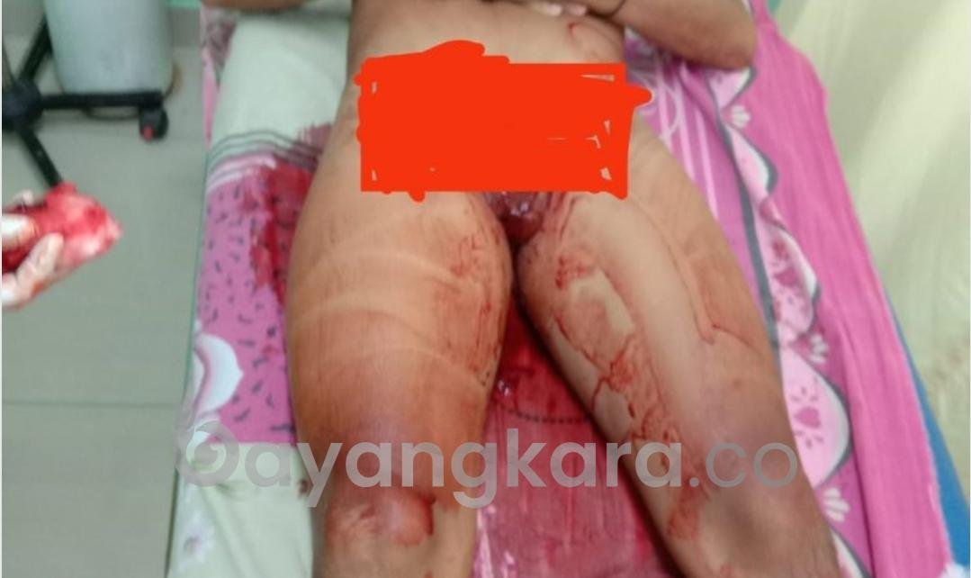 Seorang Pria Dianiaya Teman Wanitanya ” Menyayat Alat Vital