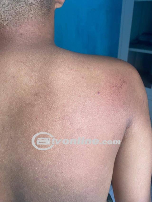 Kronologi Penderitaan Remaja P (13) sebagai Korban Salah Tangkap di Padang!
