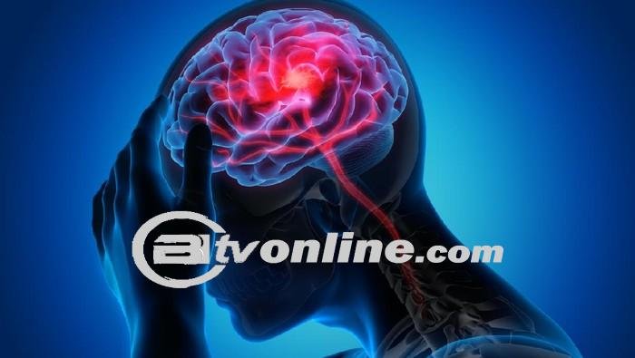 Makanan Berbahaya Yang Dapat Memicu Risiko Stroke: Apa yang Perlu Diketahui?