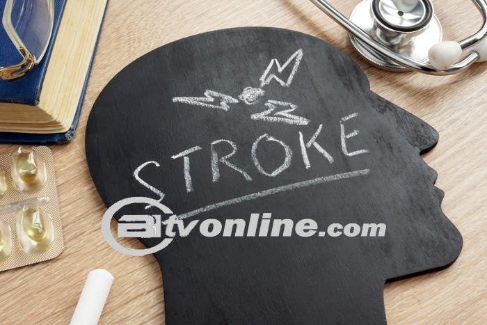 Golongan Darah A Memiliki Risiko Lebih Tinggi Terkena Stroke Sebelum Mencapai Usia 60 Tahun?!