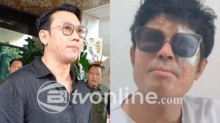 Agus Salim Tolak Rp300 Juta dari Denny Sumargo, Sebut Biaya Tak Cukup ke Singapura