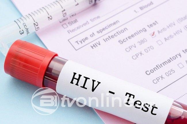 Kasus HIV/AIDS di Kabupaten Jayapura Meningkat Signifikan, Dinas Kesehatan Desak Kerja Sama Semua Pihak