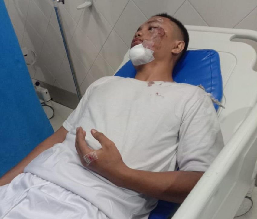 Semangat Tak Terkalahkan, Roberto Crystiano Simbolon Tetap Ikut Tes Polisi Meski Jadi Korban Begal