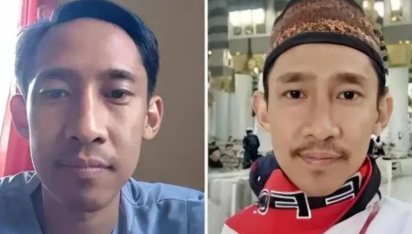 Ini Tampang Dokter PPDS UI yang Rekam Mahasiswi Mandi, Kini Diringkus Polisi