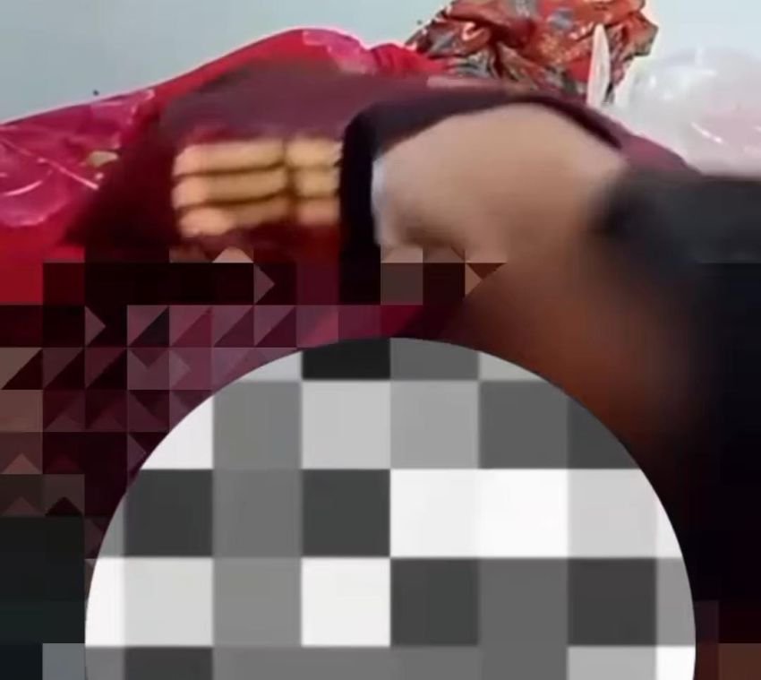 Diduga Jadi Korban Malapraktik Sunat Laser, Bocah 10 Tahun Asal Kerinci Sudah Jalani 5 Kali Operasi