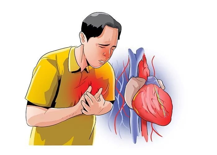 Hati-Hati! Ini 7 Makanan yang Harus Dihindari Pasien Penyakit Jantung yang Rutin Minum Obat