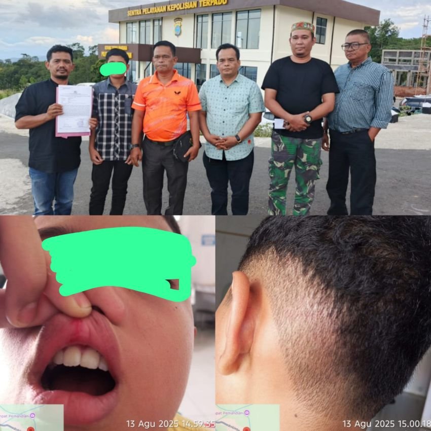 Kasus Dugaan Penganiayaan Anak di Tapanuli Selatan, Kuasa Hukum Percaya Polres Tapsel Akan Bertindak Tegas