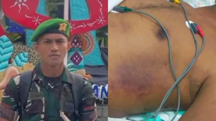 Prada Lucky Chepril Saputra Namo Meninggal Dunia Diduga Akibat Penganiayaan, Keluarga Minta Keadilan